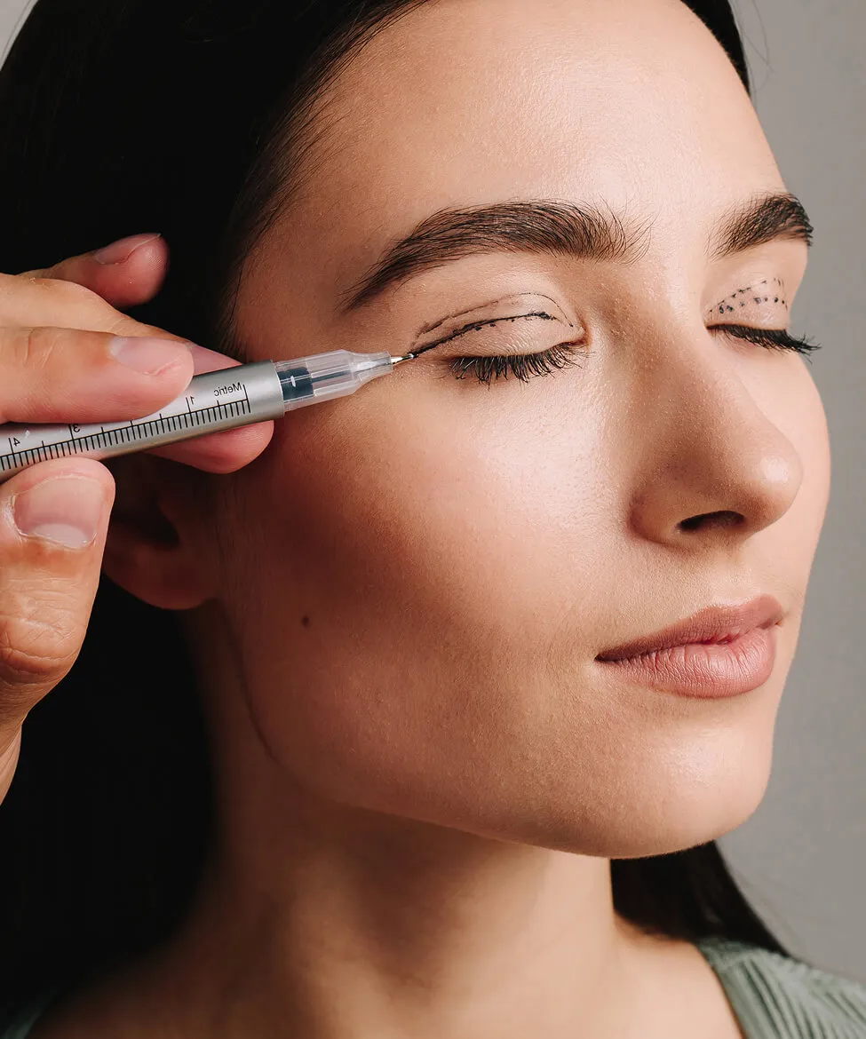 Upper blepharoplasty