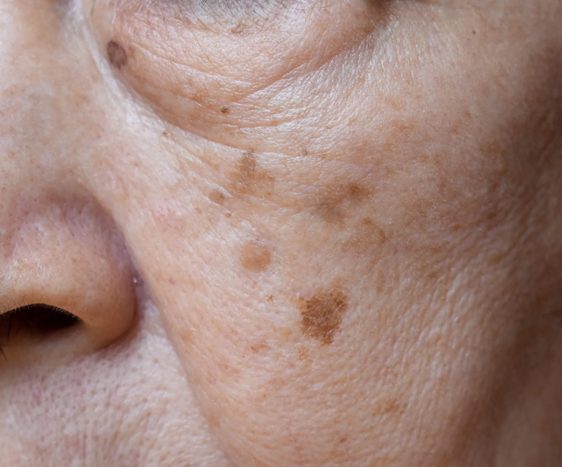 Advanced Treatment Options