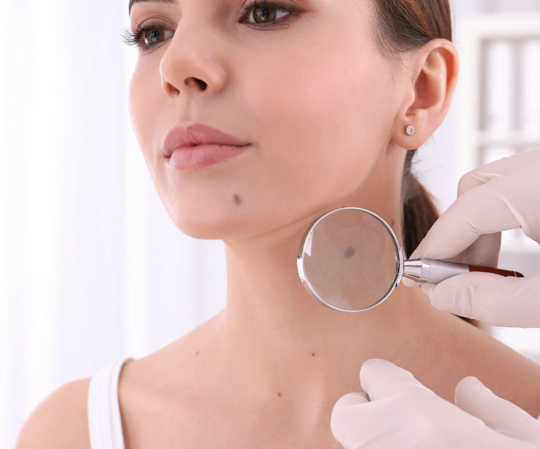 Benefits of professional removal