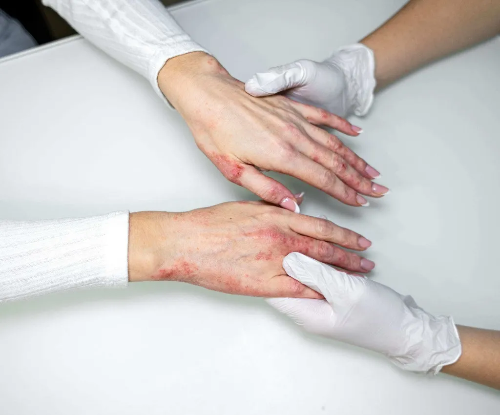 Understanding the many faces of rashes