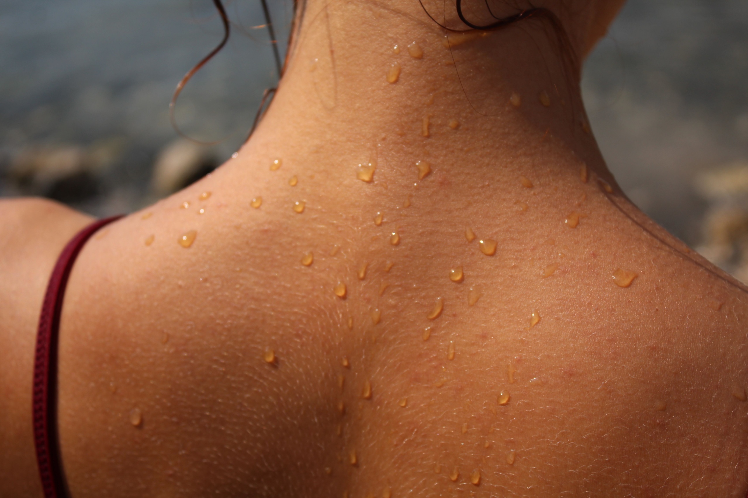 When Should You Get a Skin Cancer Screening? Image